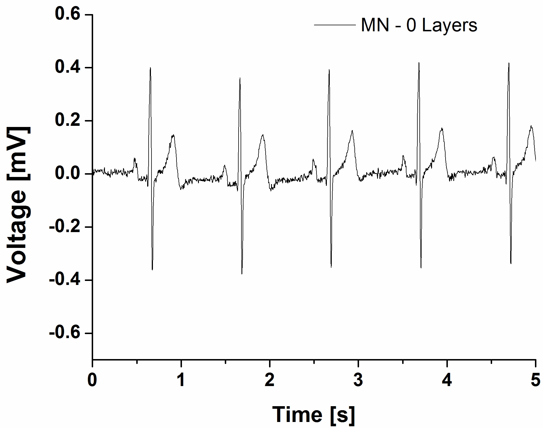Typical ECG signal recorded using Tyndall’s microneedle-based dry electrodes